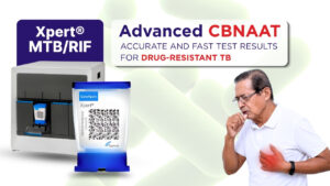 Advanced CBNAAT Testing: Fast & Accurate Detection for Drug-Resistant TB