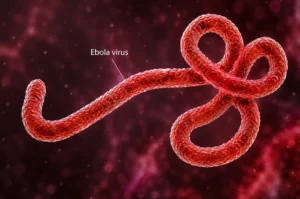 Ebola Virus Disease: Symptoms, Risks, and What You Need to Know