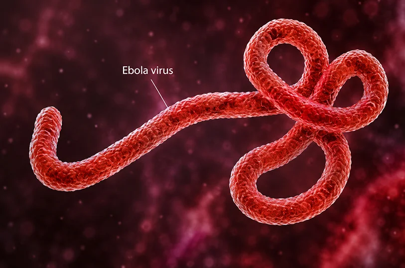 Ebola Virus Disease