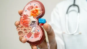 Ignoring These Kidney Disease Symptoms Could Be Dangerous